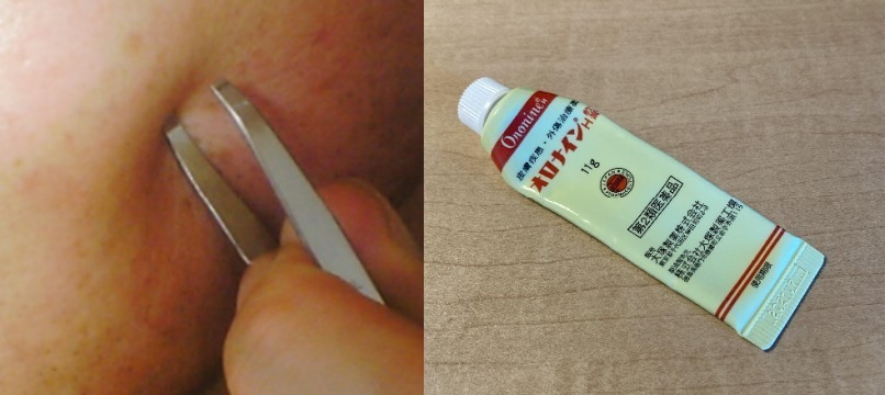オロナイン軟膏とヒゲを抜く様子
