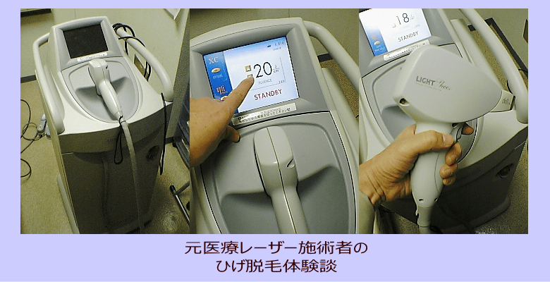 元医療レーザー施術者の ひげ脱毛体験談